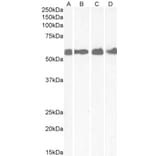 Western Blot - Anti-CRF1/CRHR1 Antibody (A84396) - Antibodies.com