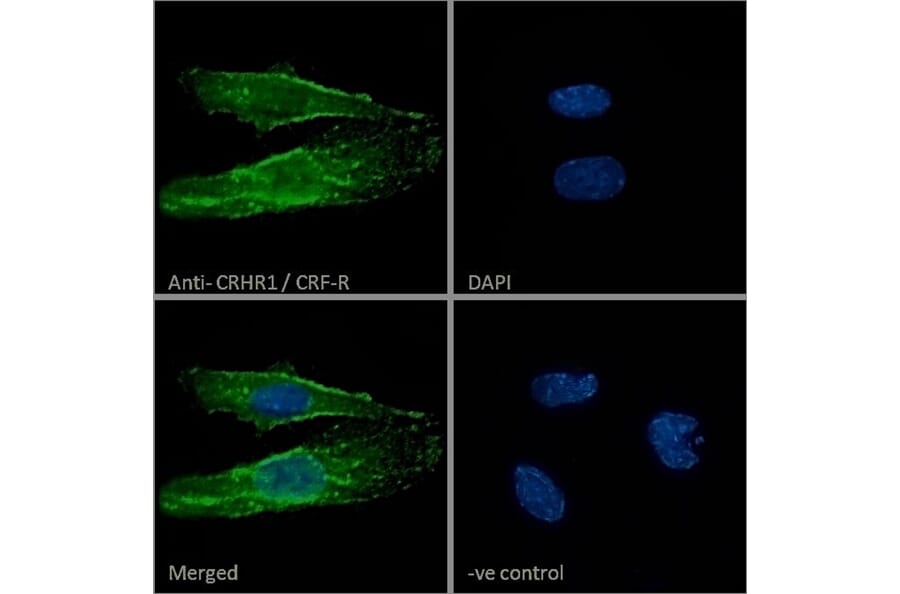 Immunofluorescence - Anti-CRF1/CRHR1 Antibody (A84396) - Antibodies.com