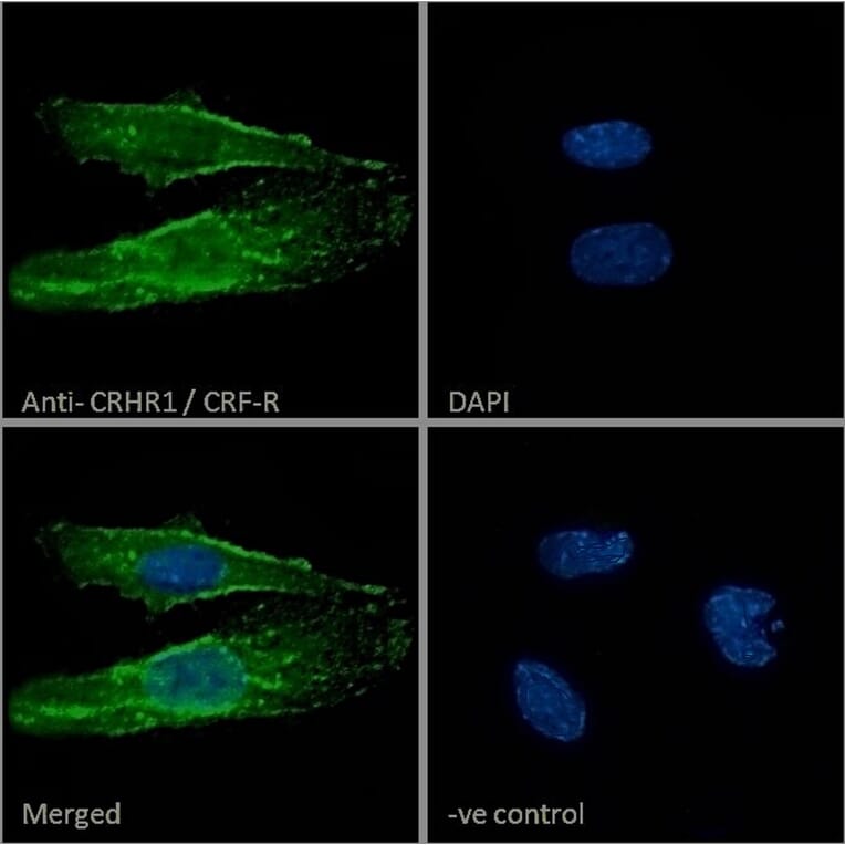 Immunofluorescence - Anti-CRF1/CRHR1 Antibody (A84396) - Antibodies.com