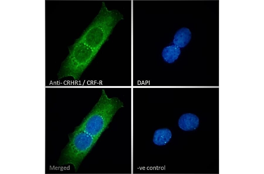 Immunofluorescence - Anti-CRF1/CRHR1 Antibody (A84396) - Antibodies.com