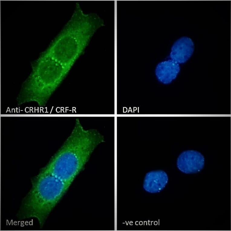 Immunofluorescence - Anti-CRF1/CRHR1 Antibody (A84396) - Antibodies.com