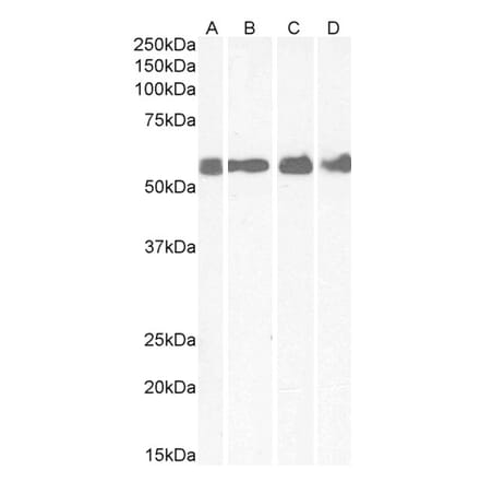Western Blot - Anti-CRHR1 Antibody (A84396)