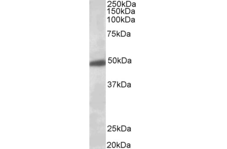 Western Blot - Anti-GIRK2 Antibody (A84397) - Antibodies.com
