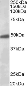 Anti-KCNJ6 Antibody (A84397) (0.5µg/ml) staining of Human Brain (Substantia Nigra) lysate (35µg protein in RIPA buffer). Primary incubation was 1 hour. Detected by chemiluminescence.
