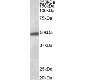 Western Blot - Anti-KCNJ6 Antibody (A84397) - Antibodies.com