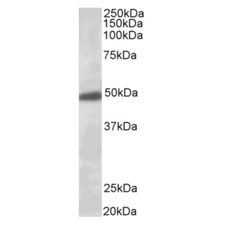 Western Blot - Anti-KCNJ6 Antibody (A84397) - Antibodies.com