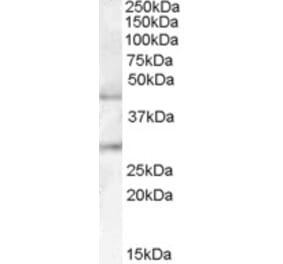Western Blot - Anti-B3GNT1 Antibody (A84398) - Antibodies.com