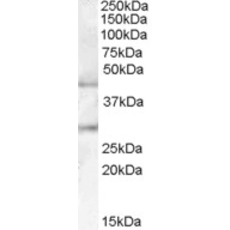 Western Blot - Anti-B3GNT1 Antibody (A84398) - Antibodies.com