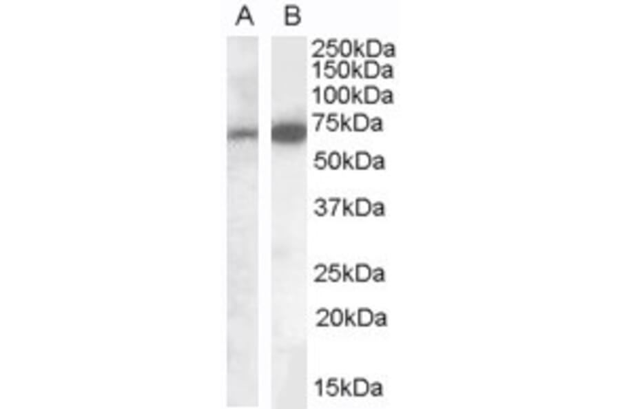 Western Blot - Anti-Cell Adhesion Molecule 4 Antibody (A84399) - Antibodies.com
