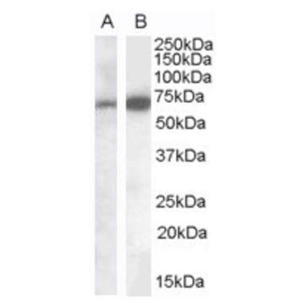Western Blot - Anti-Cell Adhesion Molecule 4 Antibody (A84399) - Antibodies.com