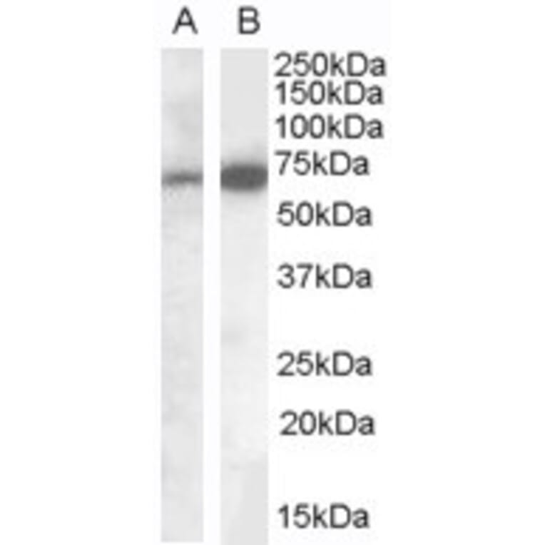 Western Blot - Anti-Cell Adhesion Molecule 4 Antibody (A84399) - Antibodies.com