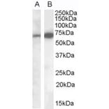 Western Blot - Anti-Cell Adhesion Molecule 4 Antibody (A84399) - Antibodies.com
