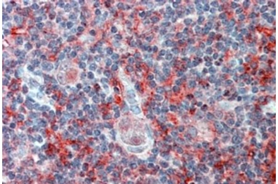 Immunohistochemistry - Anti-Cell Adhesion Molecule 4 Antibody (A84399) - Antibodies.com