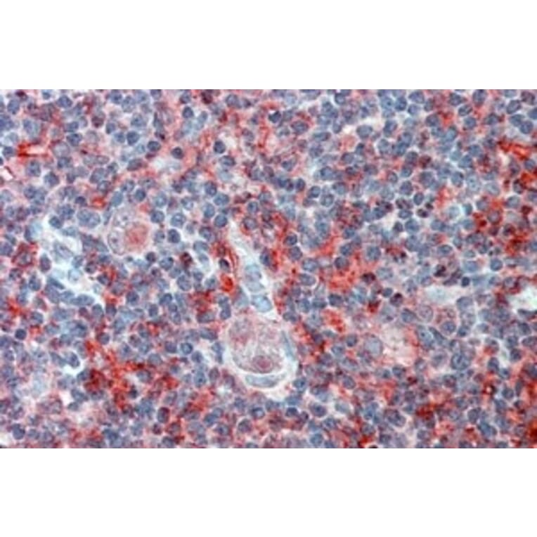Immunohistochemistry - Anti-Cell Adhesion Molecule 4 Antibody (A84399) - Antibodies.com