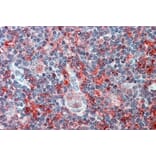 Immunohistochemistry - Anti-Cell Adhesion Molecule 4 Antibody (A84399) - Antibodies.com