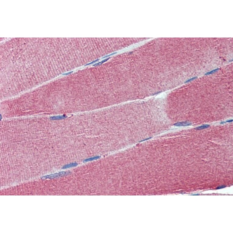 Immunohistochemistry - Anti-Cell Adhesion Molecule 4 Antibody (A84399) - Antibodies.com