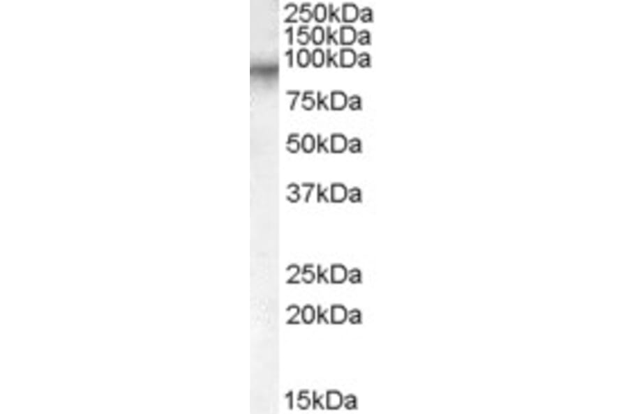 Western Blot - Anti-Factor XIIIa Antibody (A84401) - Antibodies.com