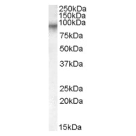 Western Blot - Anti-Factor XIIIa Antibody (A84401) - Antibodies.com