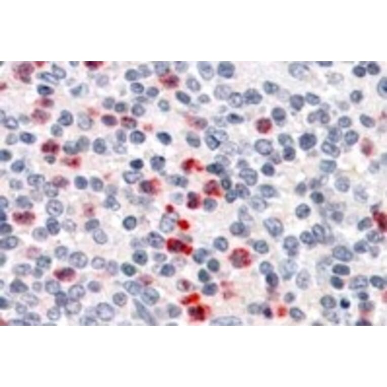 Immunohistochemistry - Anti-PGRPS Antibody (A84402) - Antibodies.com