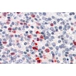 Immunohistochemistry - Anti-PGRPS Antibody (A84402) - Antibodies.com