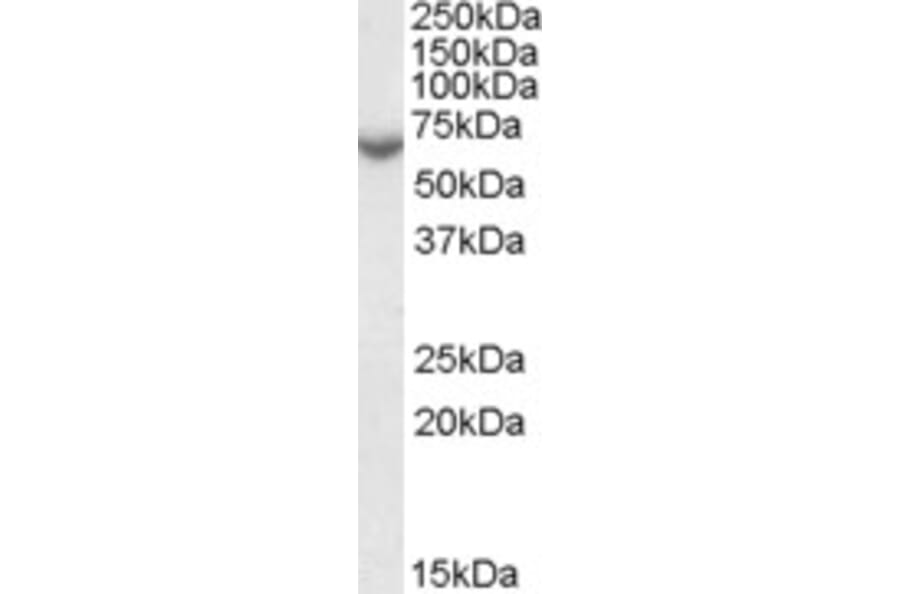 Western Blot - Anti-Steroid Sulfatase Antibody (A84404) - Antibodies.com