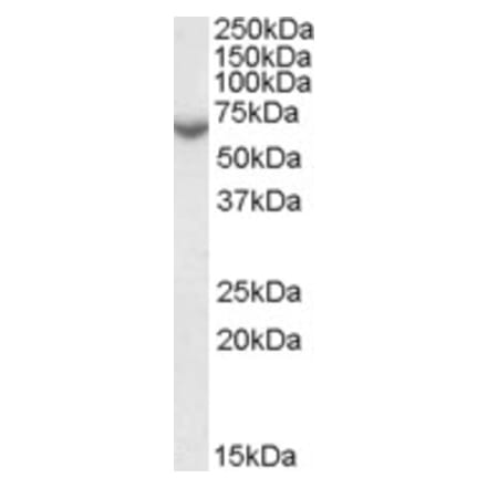 Western Blot - Anti-Steroid Sulfatase Antibody (A84404) - Antibodies.com