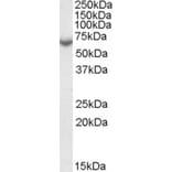 Western Blot - Anti-Steroid Sulfatase Antibody (A84404) - Antibodies.com