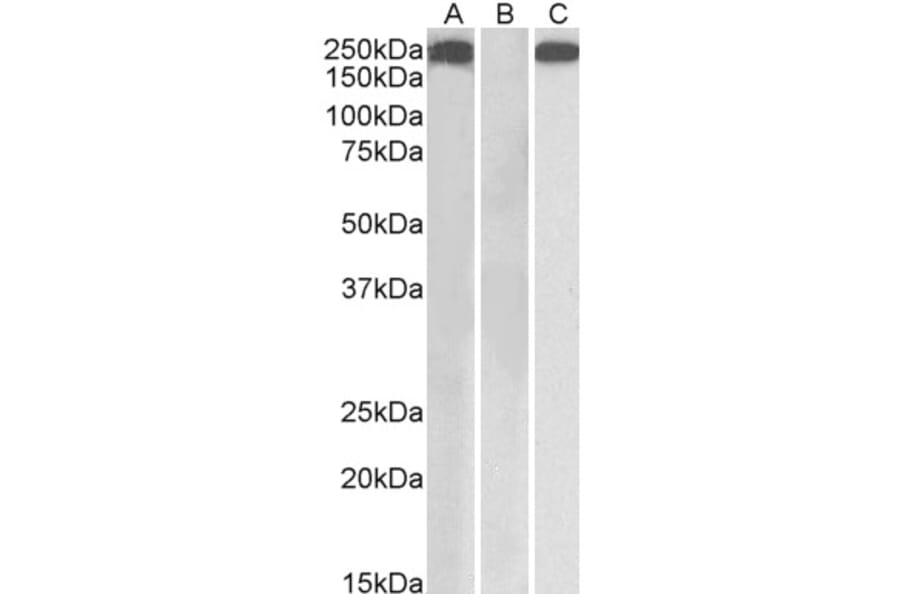 Western Blot - Anti-Thrombospondin Antibody (A84405) - Antibodies.com