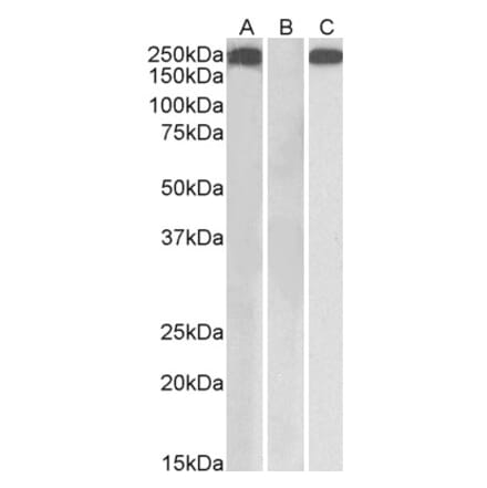 Western Blot - Anti-Thrombospondin Antibody (A84405) - Antibodies.com