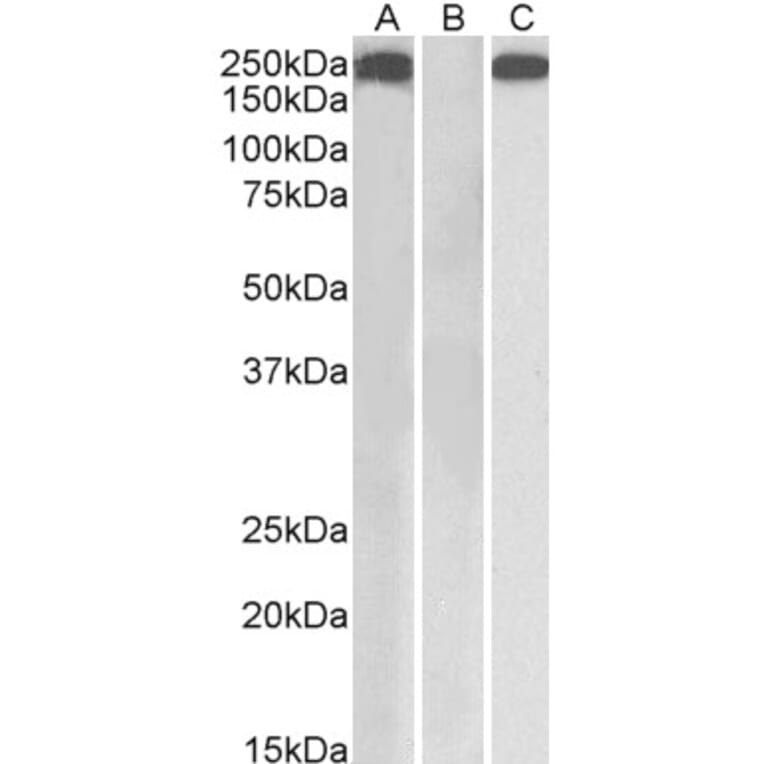 Western Blot - Anti-Thrombospondin Antibody (A84405) - Antibodies.com