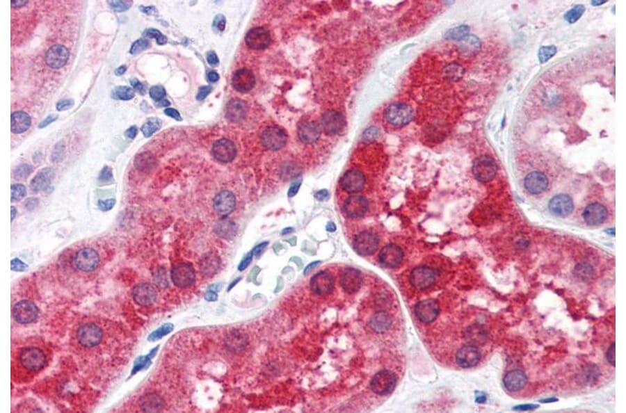 Immunohistochemistry - Anti-ABHD4 Antibody (A84407) - Antibodies.com