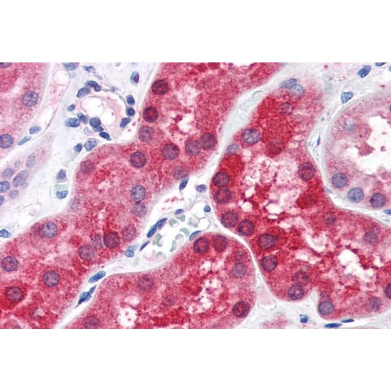 Immunohistochemistry - Anti-ABHD4 Antibody (A84407) - Antibodies.com