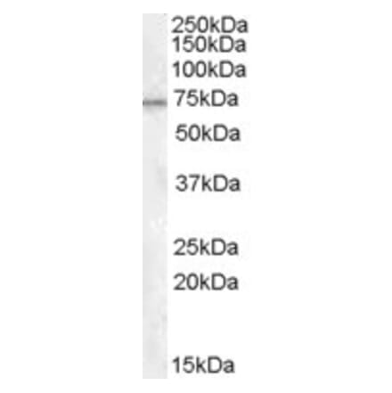Western Blot - Anti-MEPCE Antibody (A84408) - Antibodies.com
