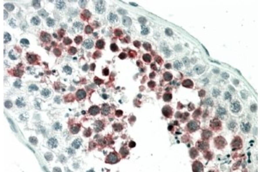 Immunohistochemistry - Anti-MEPCE Antibody (A84408) - Antibodies.com