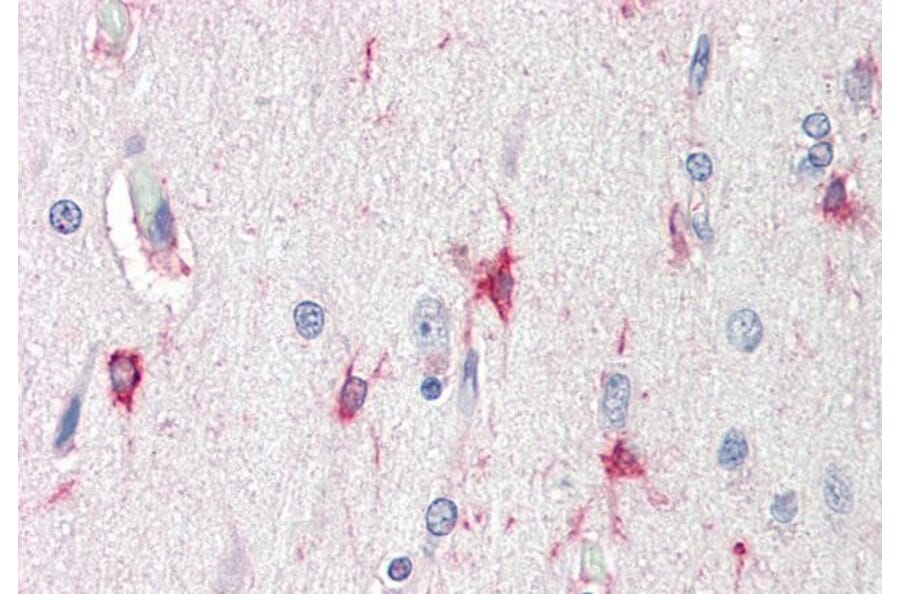 Immunohistochemistry - Anti-Bag3 Antibody (A84412) - Antibodies.com
