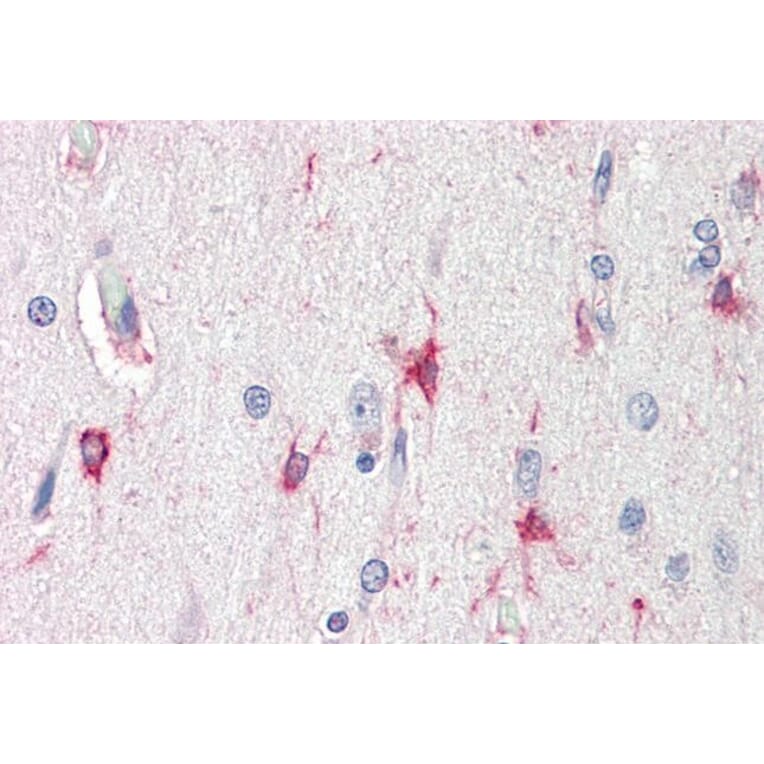 Immunohistochemistry - Anti-Bag3 Antibody (A84412) - Antibodies.com