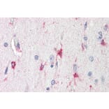 Immunohistochemistry - Anti-Bag3 Antibody (A84412) - Antibodies.com