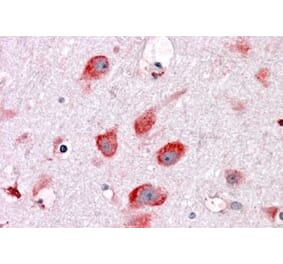 Immunohistochemistry - Anti-RPL22 Antibody (A84413) - Antibodies.com