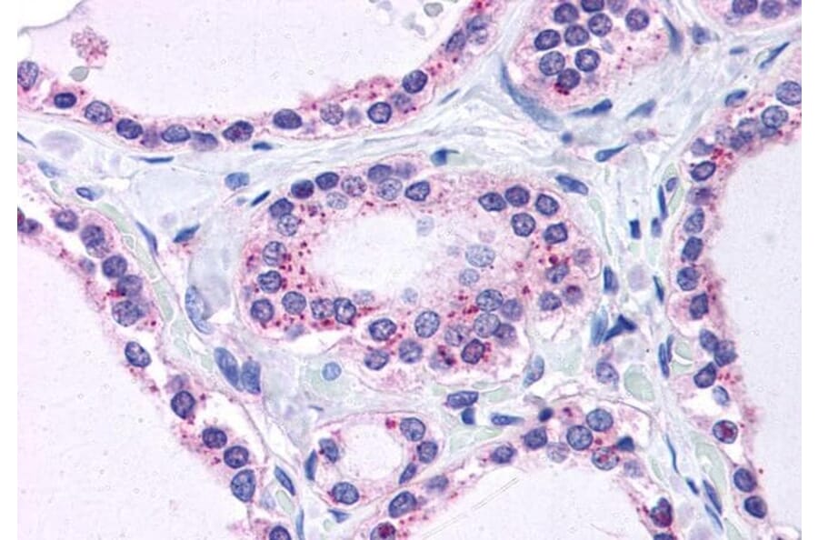 Immunohistochemistry - Anti-RPL22 Antibody (A84413) - Antibodies.com