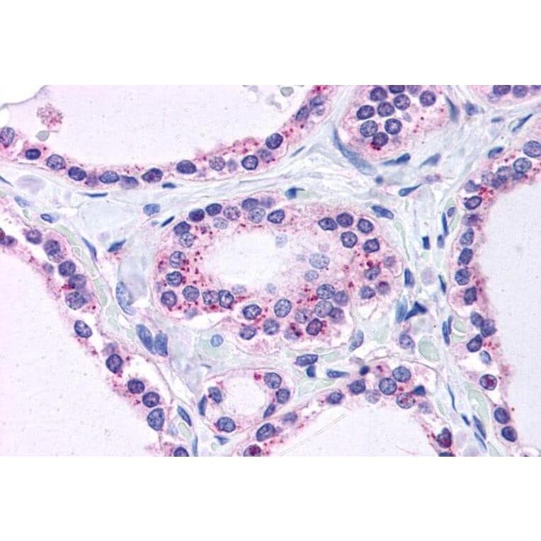 Immunohistochemistry - Anti-RPL22 Antibody (A84413) - Antibodies.com