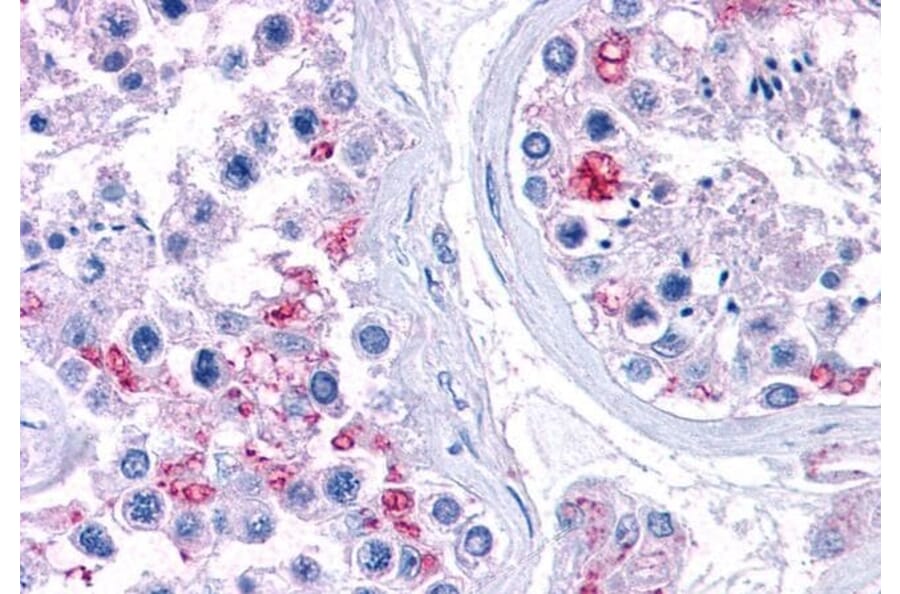 Immunohistochemistry - Anti-RPL22 Antibody (A84413) - Antibodies.com