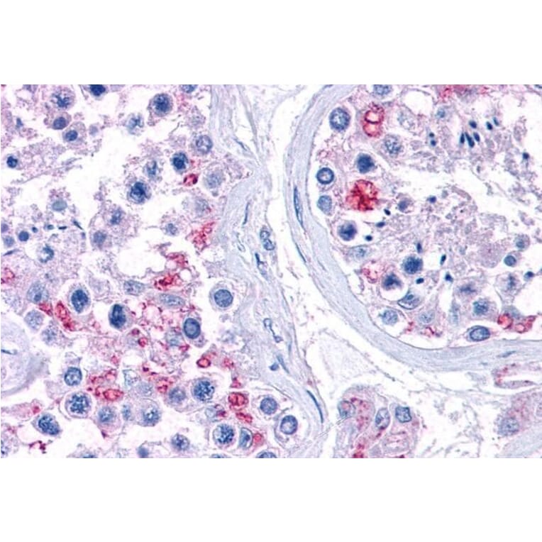 Immunohistochemistry - Anti-RPL22 Antibody (A84413) - Antibodies.com