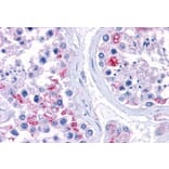 Immunohistochemistry - Anti-RPL22 Antibody (A84413) - Antibodies.com