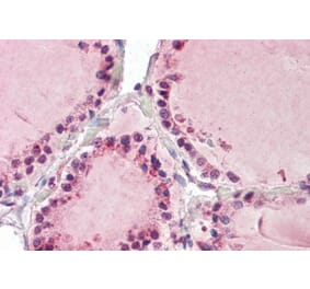 Immunohistochemistry - Anti-TAB3 Antibody (A84414) - Antibodies.com