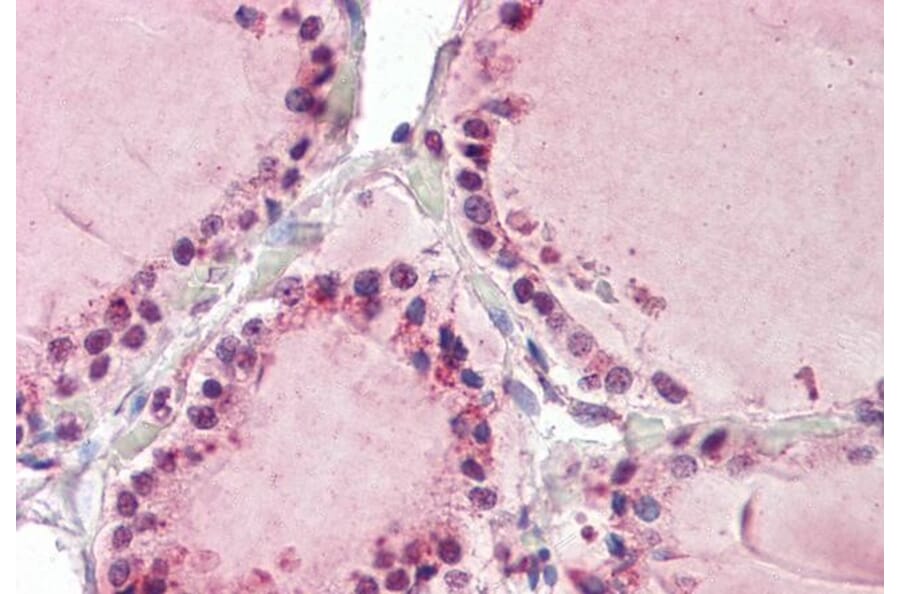 Immunohistochemistry - Anti-TAB3 Antibody (A84414) - Antibodies.com
