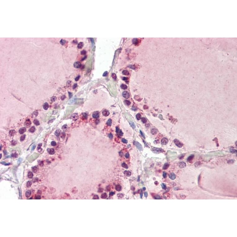 Immunohistochemistry - Anti-TAB3 Antibody (A84414) - Antibodies.com