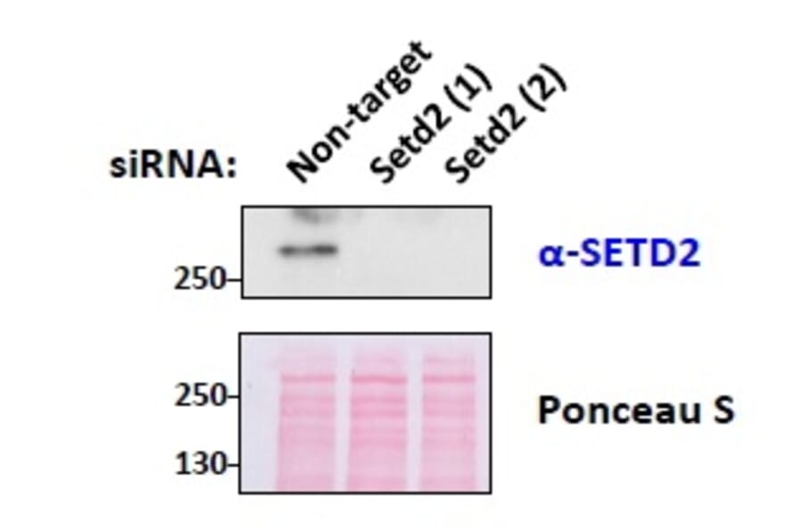 Western Blot - Anti-SETD2 Antibody (A84416) - Antibodies.com