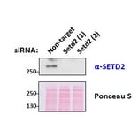 Western Blot - Anti-SETD2 Antibody (A84416) - Antibodies.com