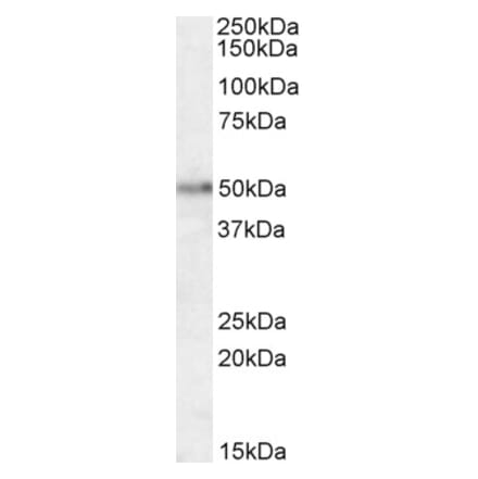 Western Blot - Anti-Orexin Receptor 2 Antibody (A84417) - Antibodies.com