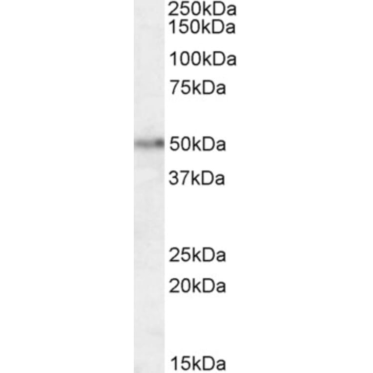 Western Blot - Anti-Orexin Receptor 2 Antibody (A84417) - Antibodies.com